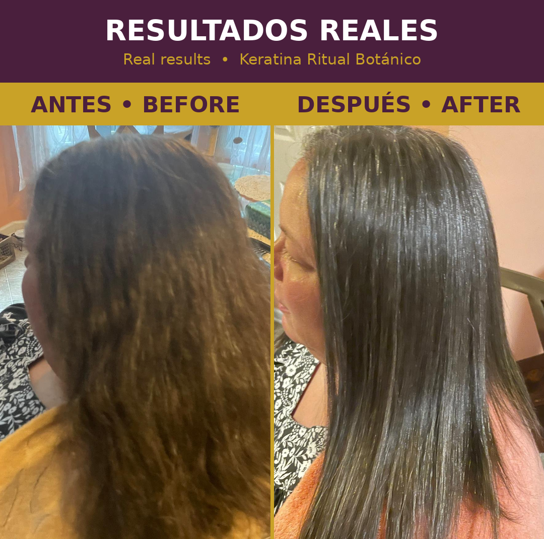 Antes y después - vista de perfil